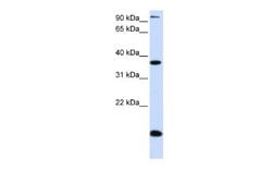 KLF8 Antibody, Novus Biologicals 100 &mu;L; Unconjugated:Antibodies, Polyclonal